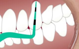 طبقة البلاك