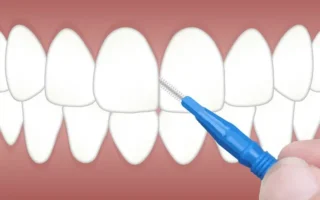 توريد اللثة