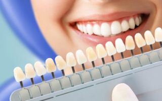 اضرار تبييض الاسنان