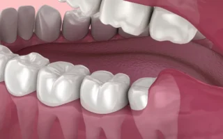 طريقة تخفيف الم عصب الاسنان