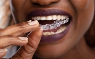 طرق مختلفة لتبييض الأسنان