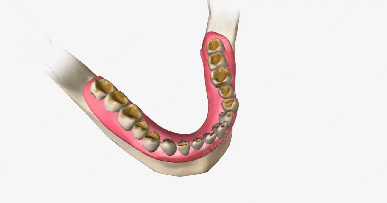 عاج الأسنان