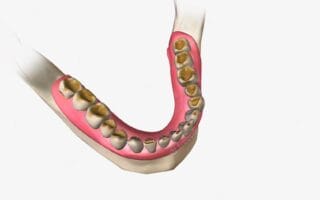 عاج الأسنان