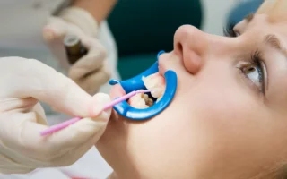 عملية زراعة الأسنان