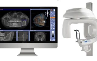 نظام زراعة الأسنان
