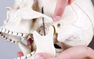 مشاكل زراعة الأسنان