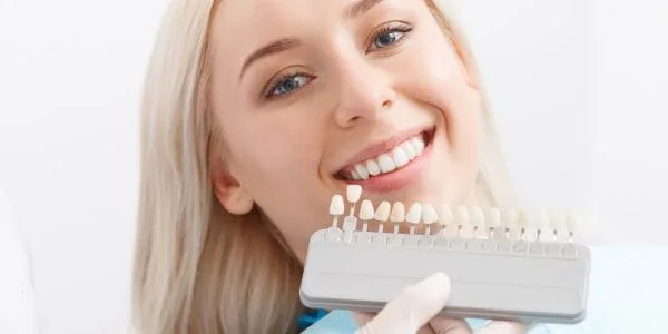 العدسات السنية اللاصقة