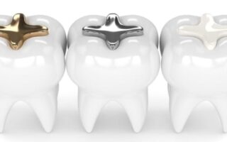 تطعيمات وحشوات الأسنان