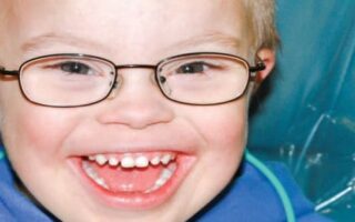 علاج أسنان الأطفال ذوي الاحتياجات الخاصة