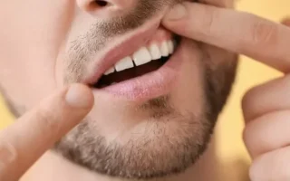 جراحة استئصال الورم اللثوي