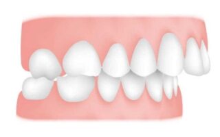 ما هي الحالات المرتبطة بصحة الفم؟