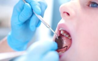 معالجة تسوس الأسنان للأطفال