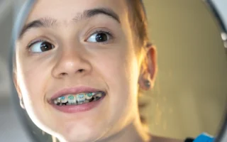 تقويم الأسنان للأطفال أمرٌ يعنى به الوالدين دائمًا، لاسيما عندما يعاني الأطفال من مشاكل تتعلق بالأسنان كالتباعد أو الازدحام