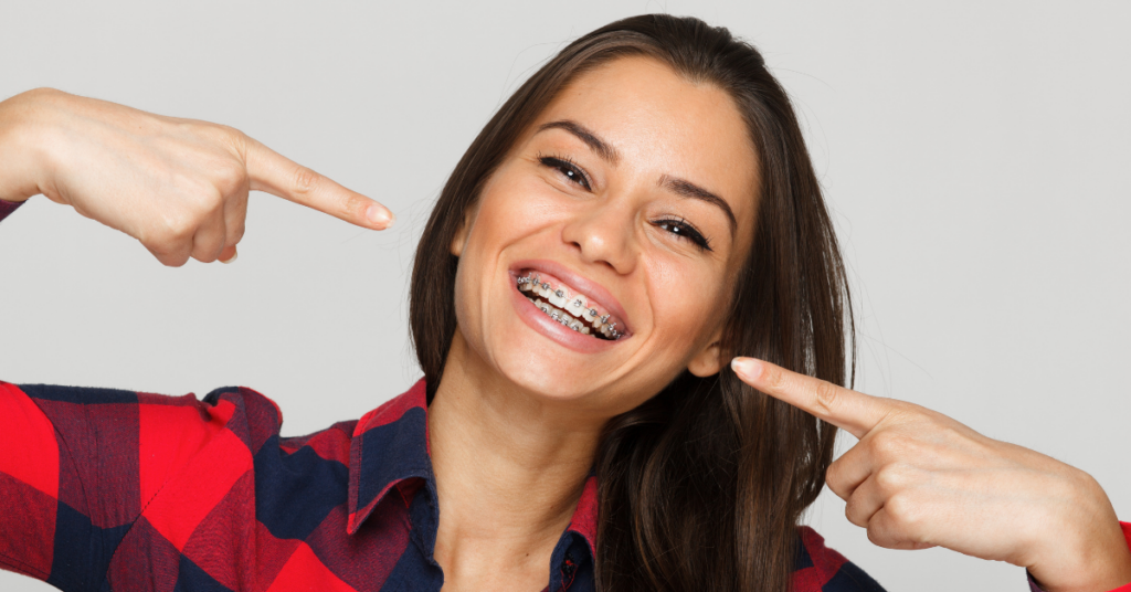 خصائص تقويم الأسنان المعدني ووظائفه: