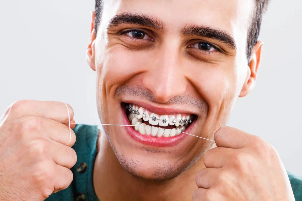 تقويم الأسنان للكبار: استعد ابتسامتك الجميلة