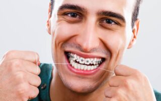 تقويم الأسنان للكبار: استعد ابتسامتك الجميلة