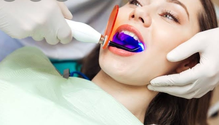 تبيض الأسنان باليزر