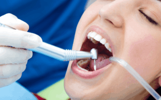 عيادات جذور الأسنان: خطوات علاج جذور الأسنان وفوائدها