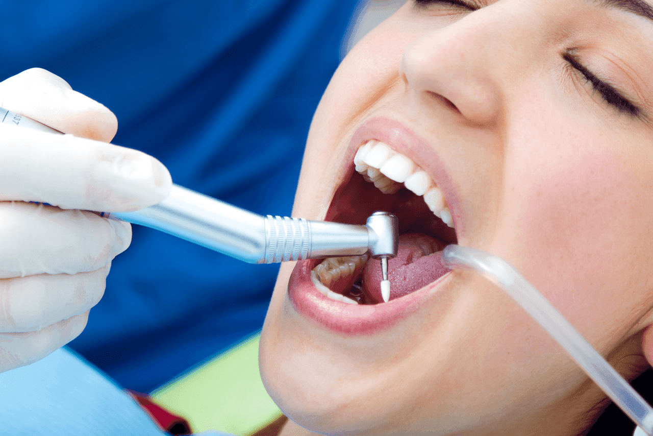 عيادات جذور الأسنان: خطوات علاج جذور الأسنان وفوائدها