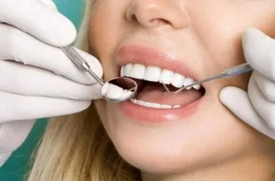 تسوس الأسنان بالصور 