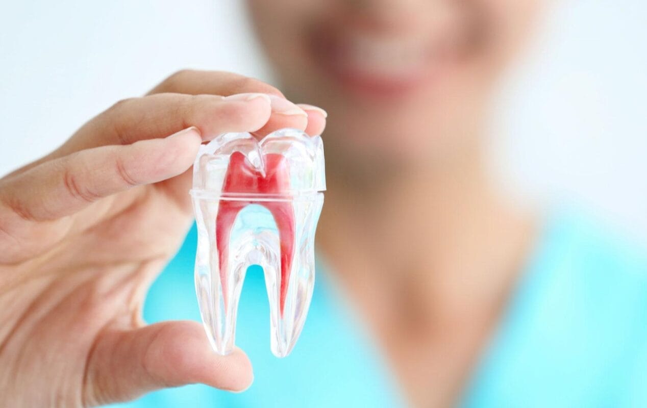 عيادة علاج تسوس جذور الأسنان