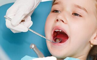 حشوات الأسنان للأطفال