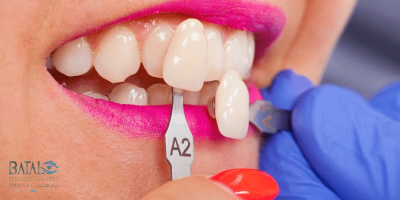 نصائح لاختيار لون الزيركون المناسب للأسنان