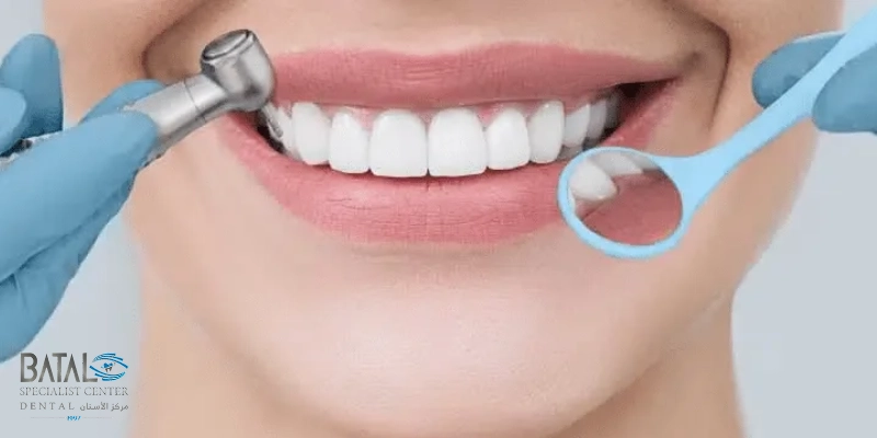 سعر اللومينير في السعودية 