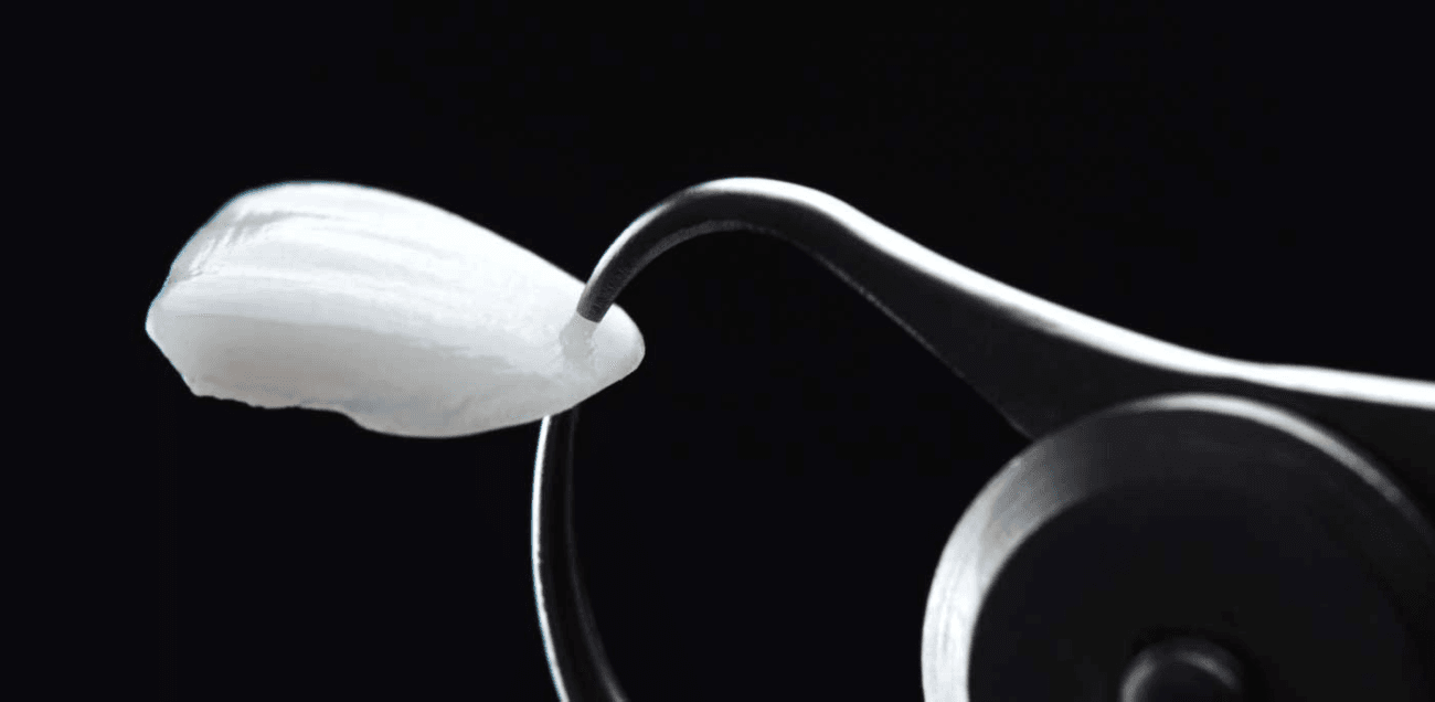 اللومينير: ابتسامة هوليوودية ساحرة