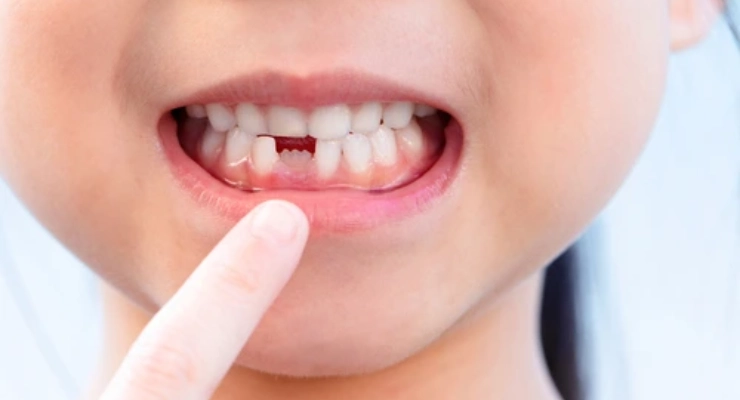 كيف يتم تشخيص مشاكل الفك لدى الأطفال؟