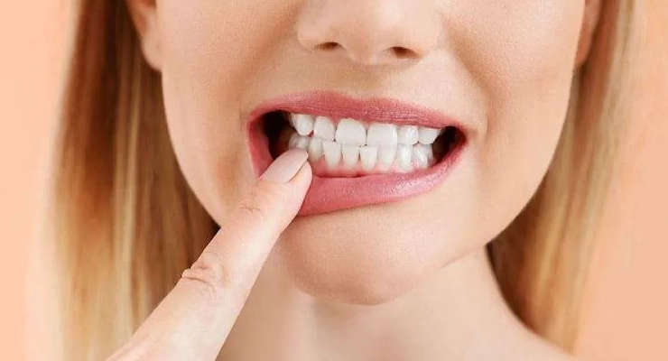 الأسباب الشائعة لألم الأسنان عند الأكل