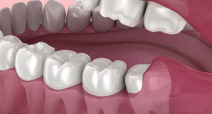 الفرق بين ألم اللثة وألم العصب 