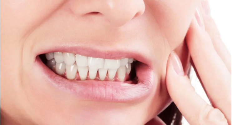 هل يمكن الوقاية من صرير الأسنان؟