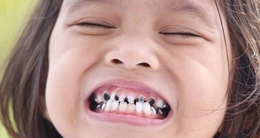 ماذا تفعل فور إصابة سن طفلك