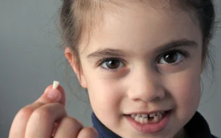 سقوط الأسنان اللبنية عند الأطفال