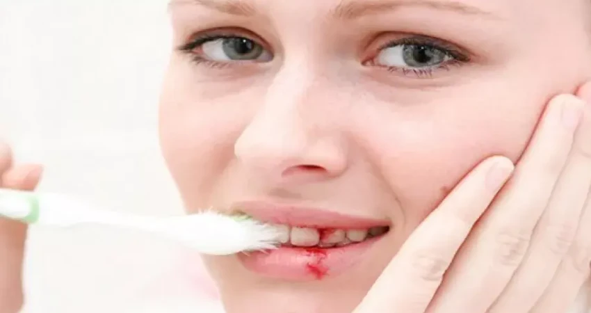 نزيف اللثة عند تنظيف الأسنان