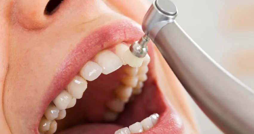 أفضل عيادة تنظيف أسنان في جدة