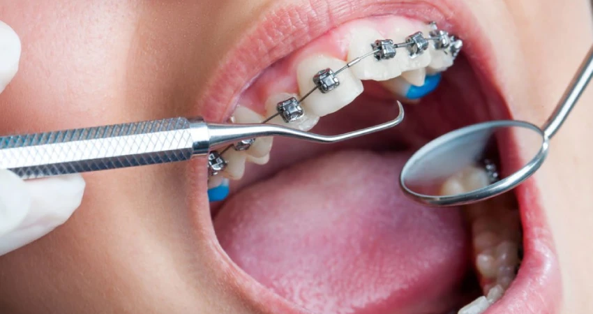 أفضل دكتور تقويم أسنان في جدة