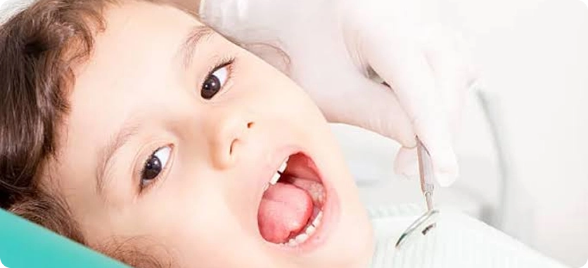 أكثر مشاكل الأسنان شيوعاً عند الأطفال